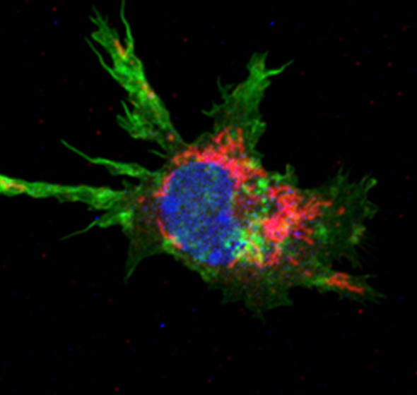 Dendritic cell (수지상세포) activation